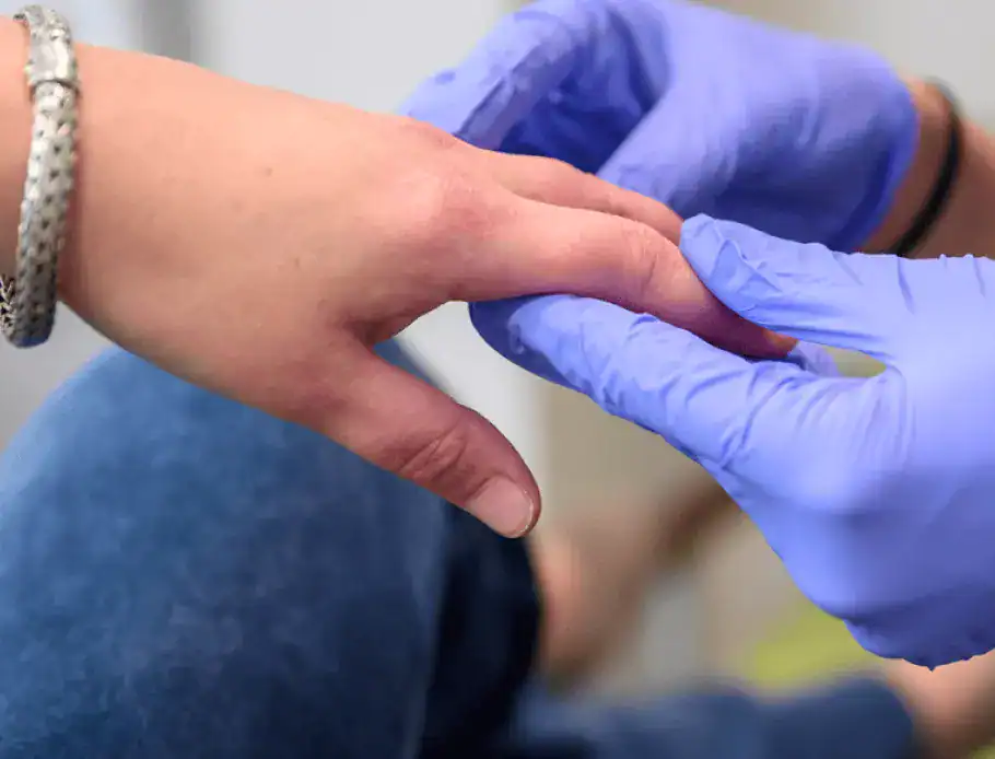 Dermatologist looking at patient's fingers